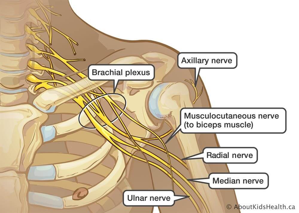 stinger-brachial-plexus-injuries